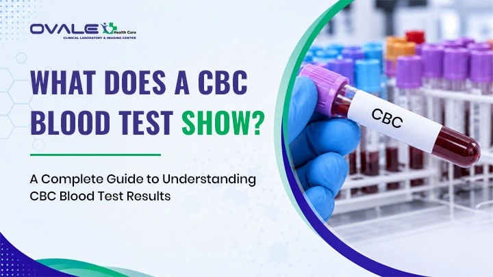 What Does a CBC Blood Test Show? A Complete Guide (2026)